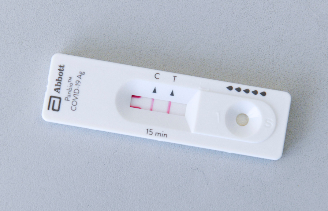 En 24 horas, Salud reporta cuatro nuevos contagios por dengue